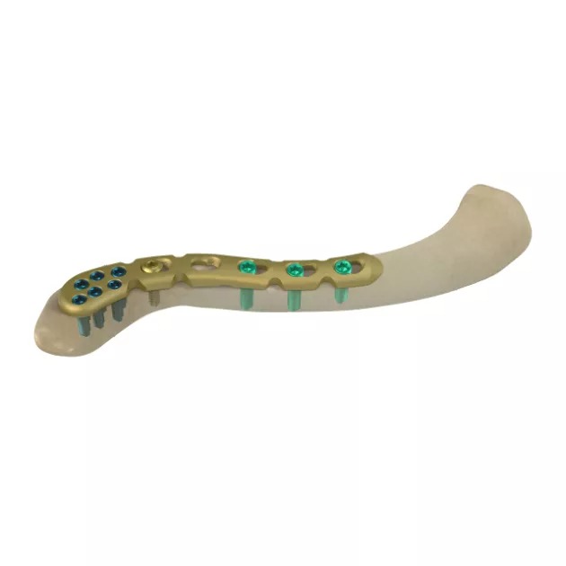 LCP Clavicle Plate with extension