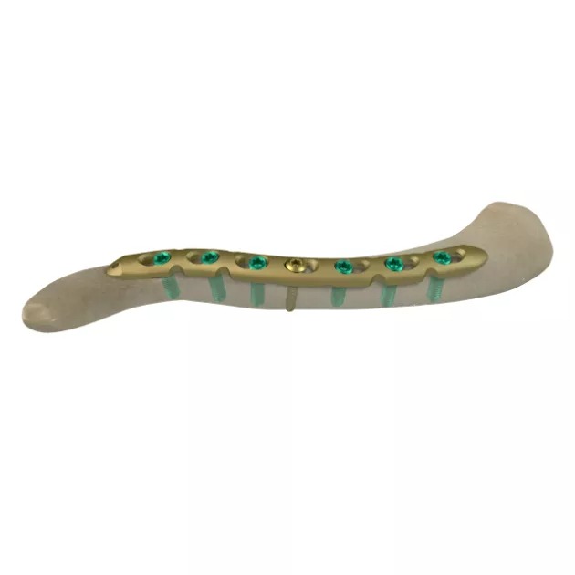 LCP Superior Clavicle Plate