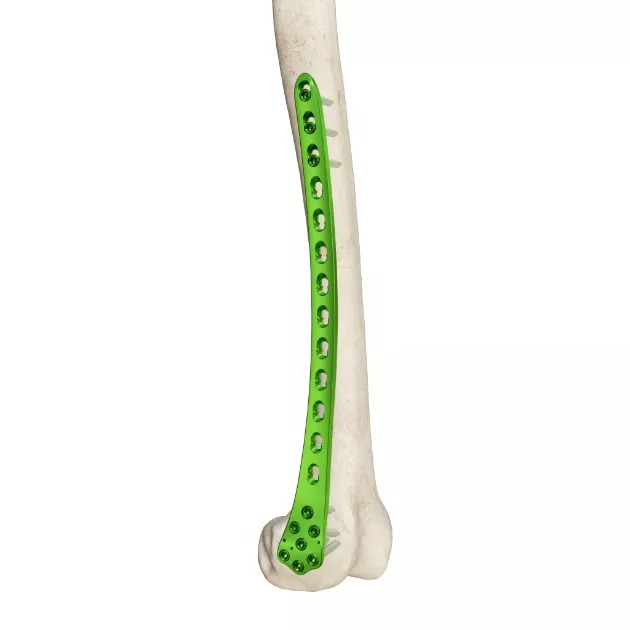 MR-Distal Lateral Femoral Plate, TC4