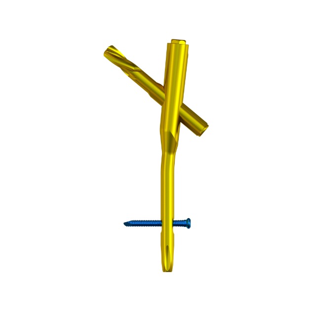 MR-IM Femoral Nail 001