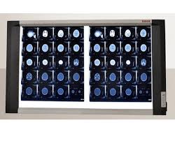 Double Screen X-Ray View box Brand: Hirayer Made in : China