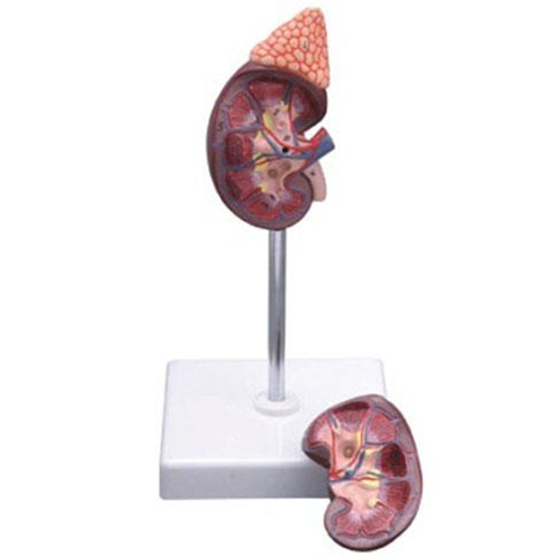 14006-2 Kidney with Adrenal Model