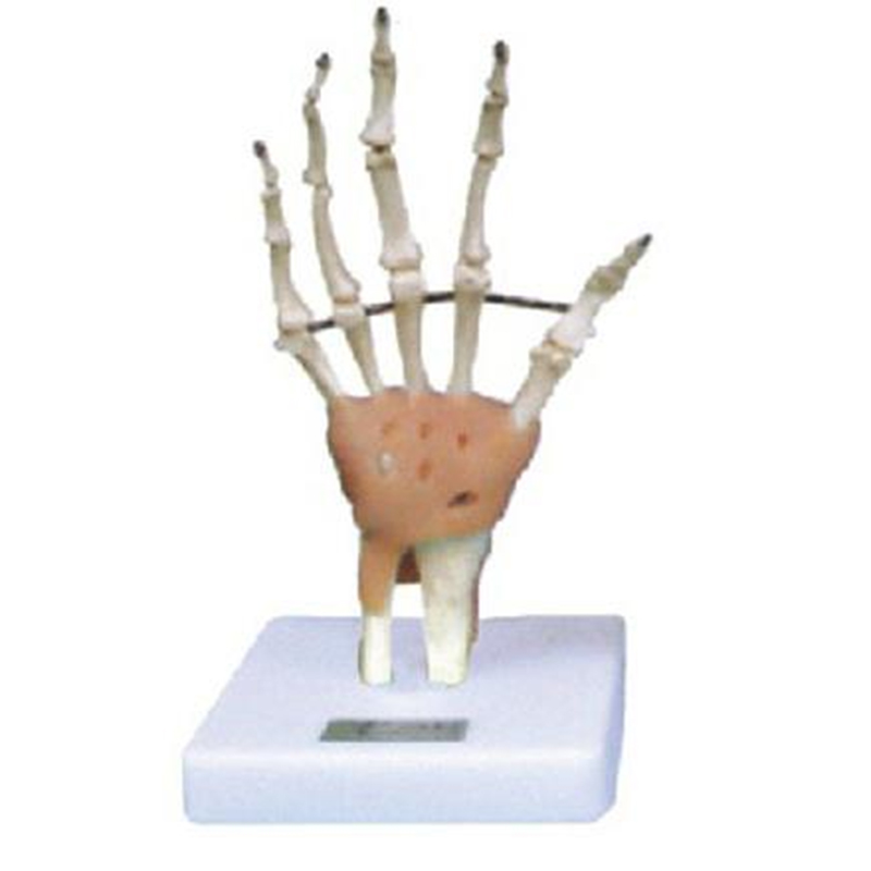11209-3 Hand and Finger Joint with Ligament Model
