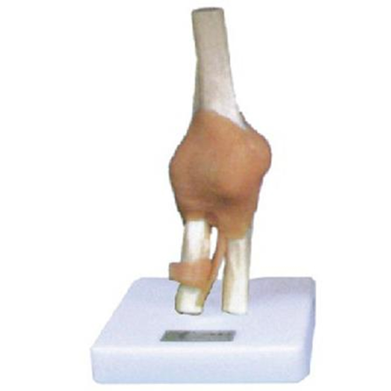 11209-2 Elbow Joint with Ligament Model