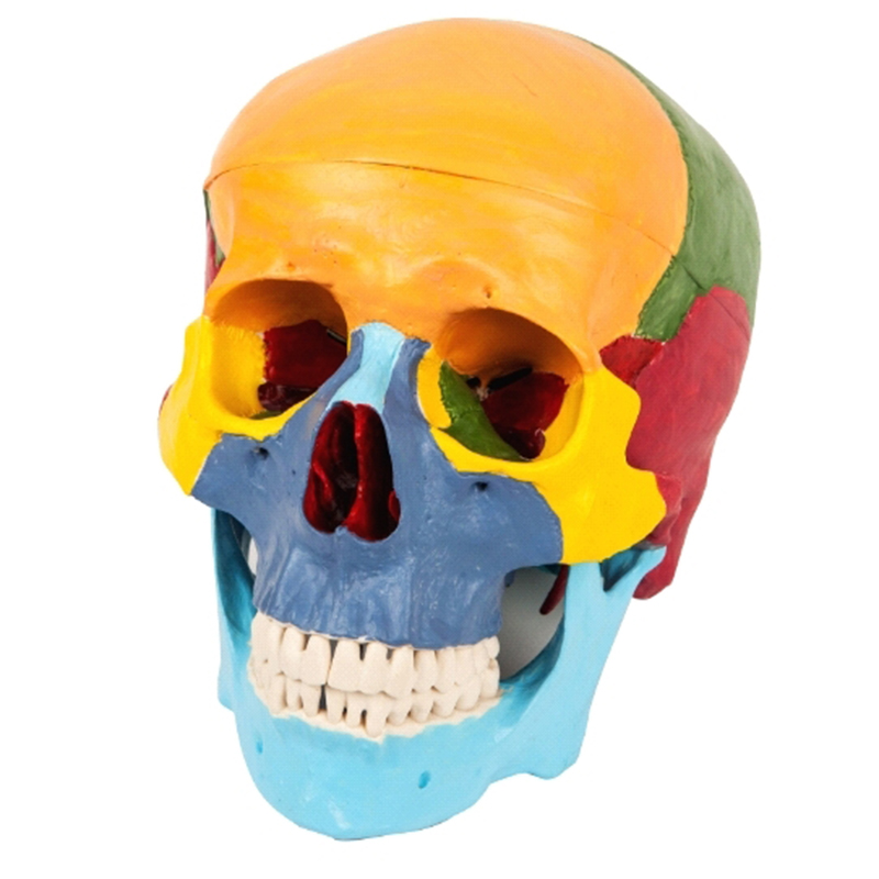 11118 Skull Separation Model