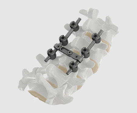 Small Fragment - Locking