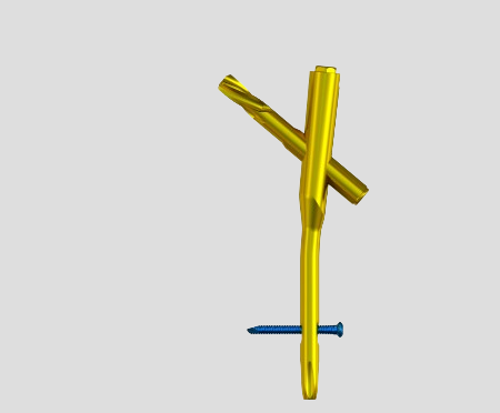 Small Fragment - Locking