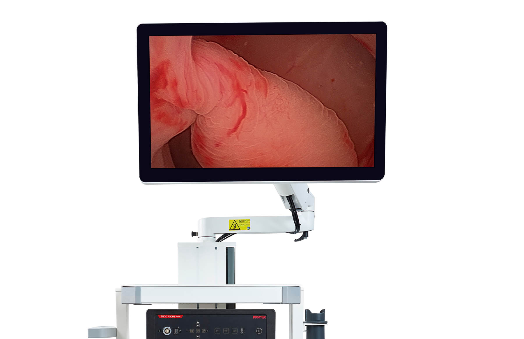 Hysteroscopy System
