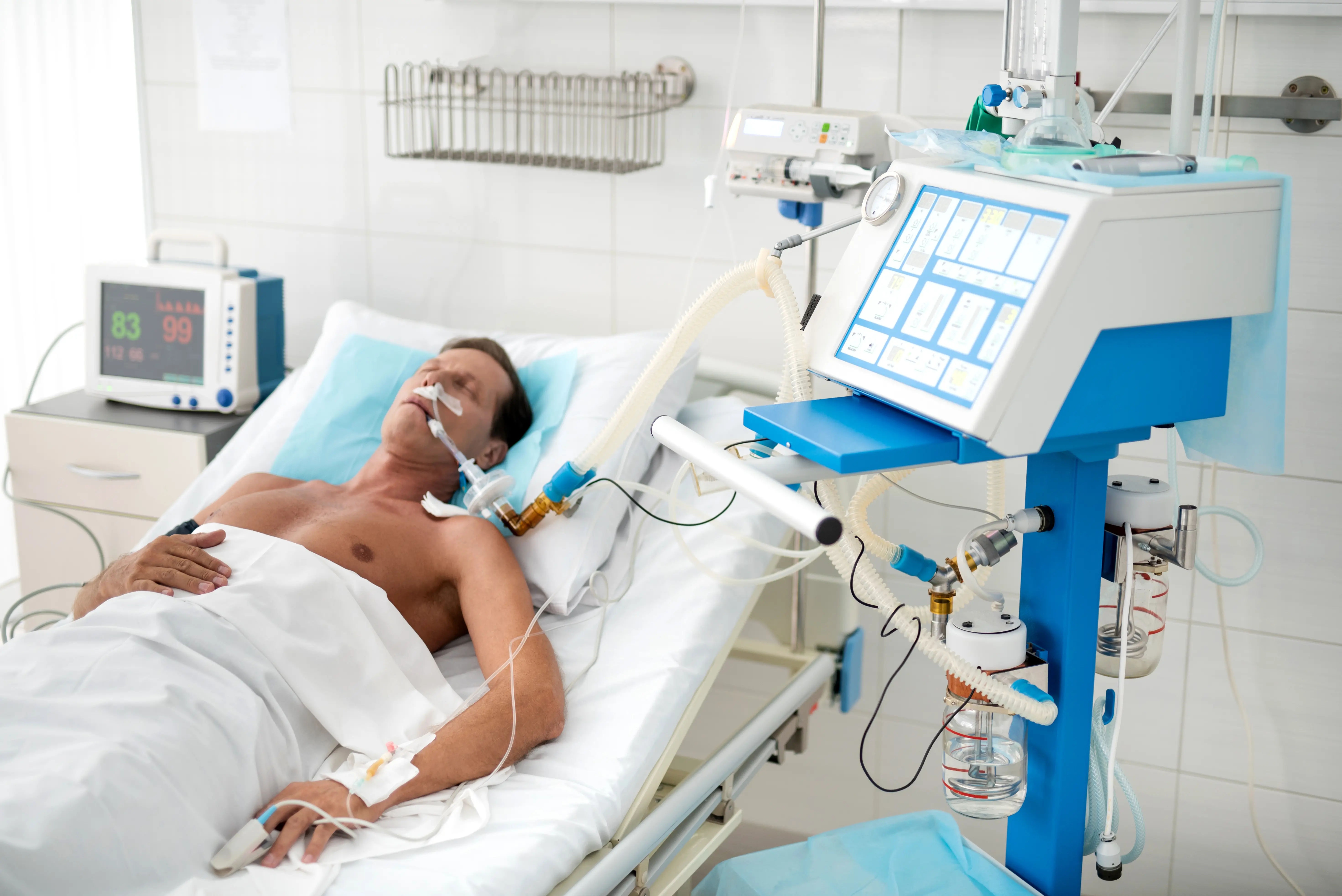 Ventilator Circuit